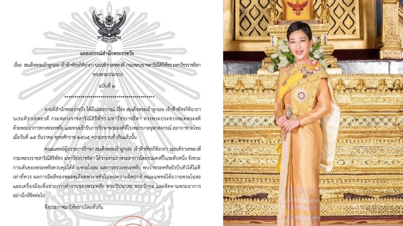 แถลงการณ์สำนักพระราชวัง ฉบับที่ 2 อาการพระประชวร "พระองค์ภา" โดยรวมคงที่ระดับหนึ่ง