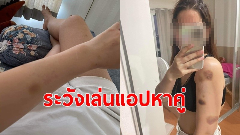 สาวสวยวัย 28 ปี โร่แจ้งความถูกหนุ่มลูกครึ่งรู้จักผ่านแอปฯ หาคู่ ทำร้ายข่มขืน ขู่ให้โอนเงิน