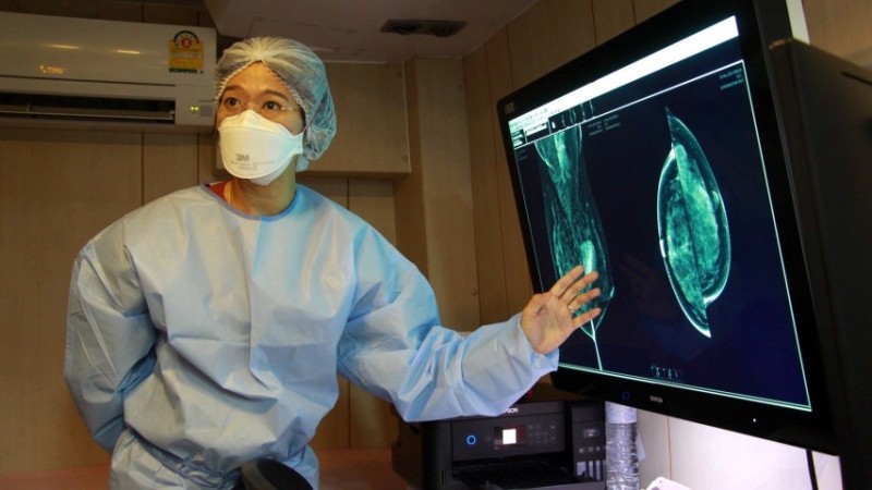 เชียงใหม่ เชิญชวนประชาชนร่วมตรวจคัดกรองมะเร็งเต้านมด้วยเครื่อง Mammogram ไม่ต้องเสียค่าใช้จ่าย